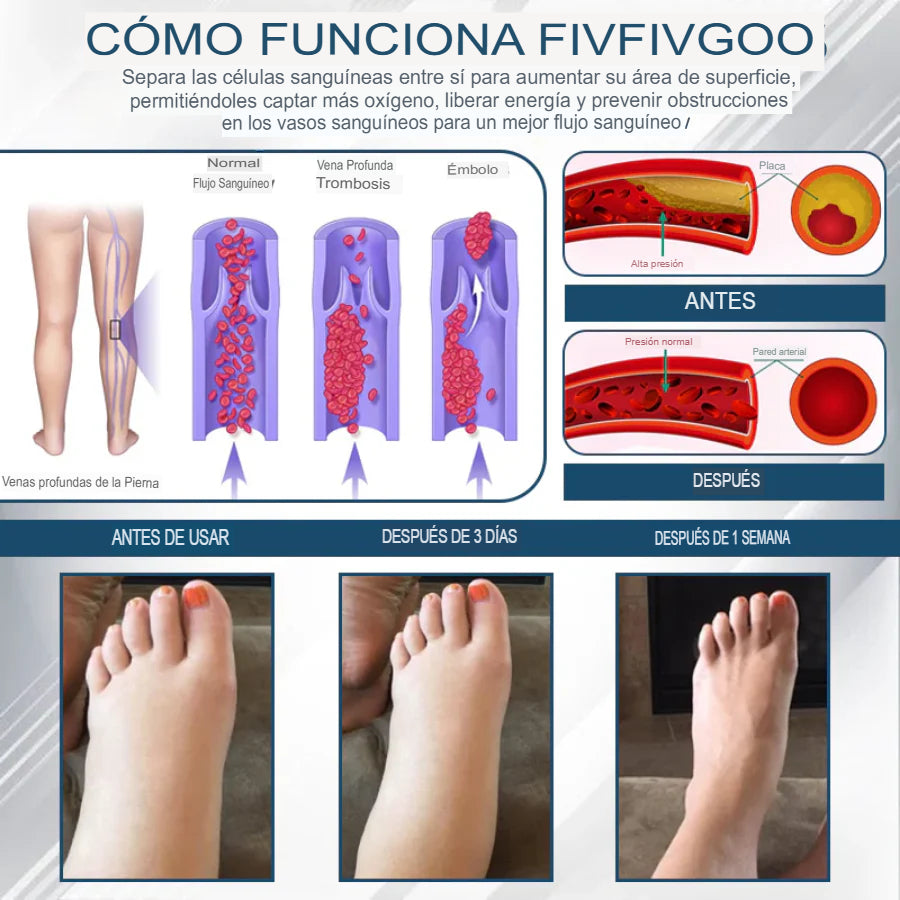 Hoygi® Black Cumin – Alivio Inmediato para Piernas Hinchadas, Pesadas y con Dolor (Edema)