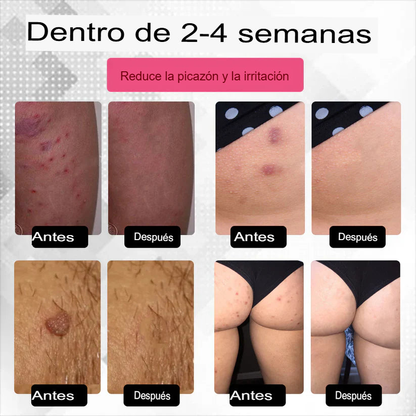 Solo Paga Al Recibir! Crema cicatrizante del VPH genital femenino