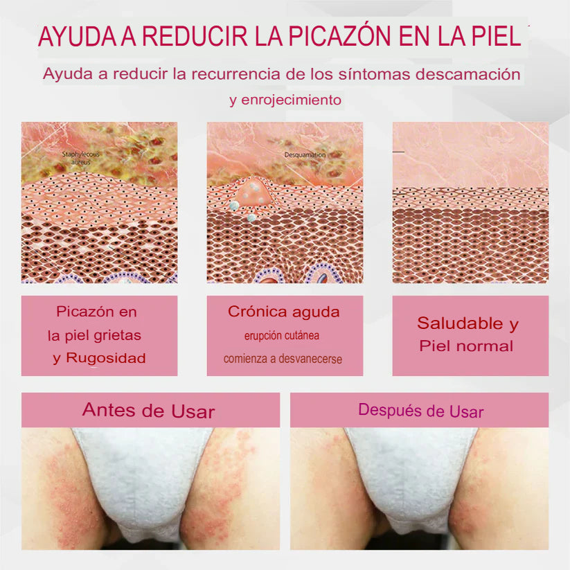 Solo Paga Al Recibir! Crema cicatrizante del VPH genital femenino