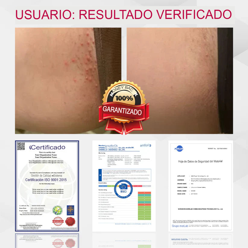 Solo Paga Al Recibir! Crema cicatrizante del VPH genital femenino